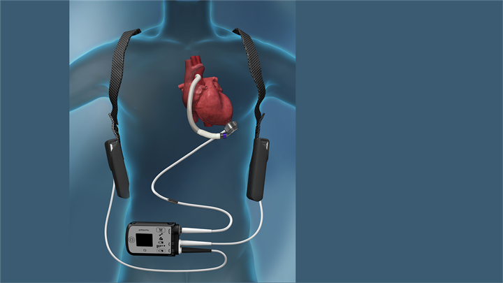 Bodovano predavanje „Kardiološka rehabilitacija pacijenta nakon ugradnje LVAD-a – prikaz slučaja”