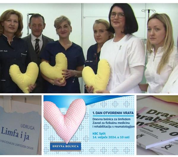 „Srce za Vas“: Održan Dan otvorenih vrata Dnevne bolnice za limfedem