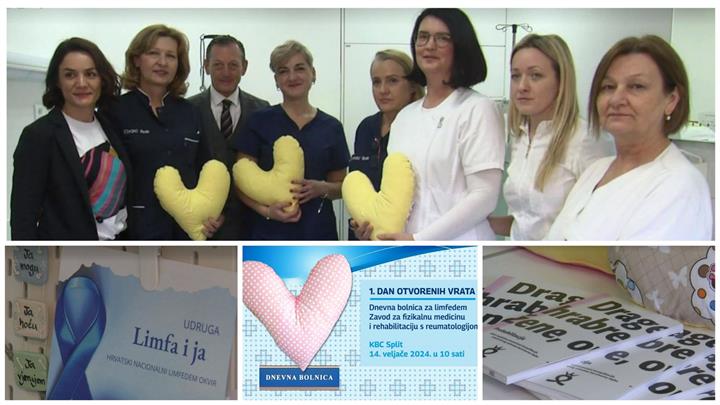 „Srce za Vas“: Održan Dan otvorenih vrata Dnevne bolnice za limfedem