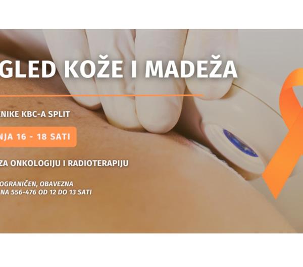 Besplatan pregled kože i madeža za sve zaposlenike KBC-a Split